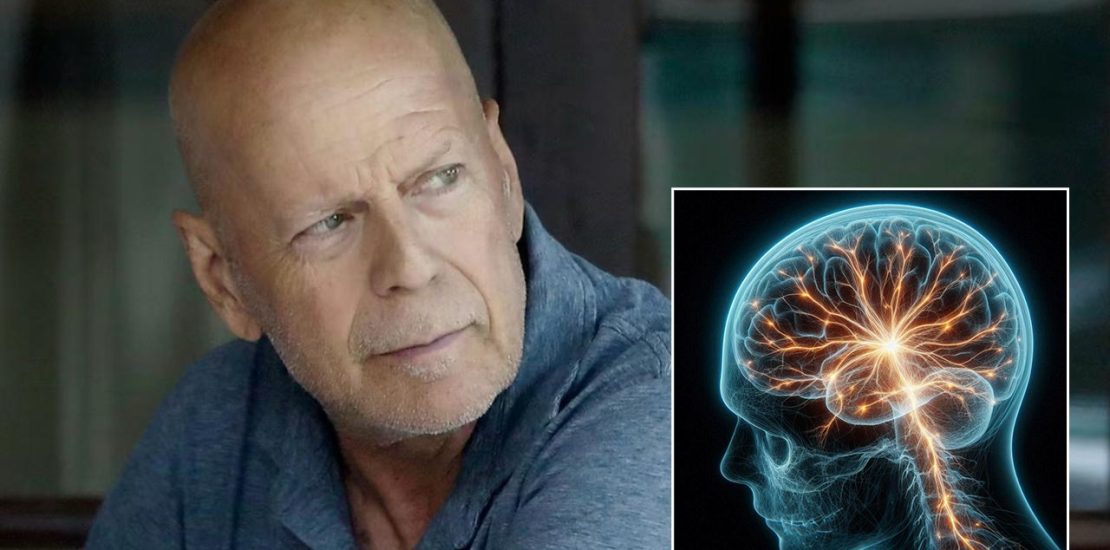 Bruce Willis y la afasia